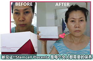 De Beauty Reborn StemCell Placenta