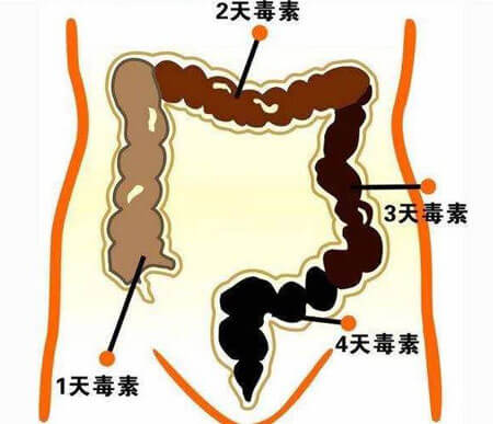 bowel1